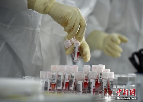 探访新冠肺炎病毒核酸检测服务